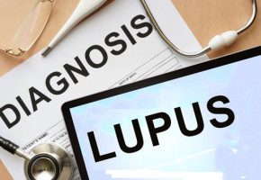 lupus